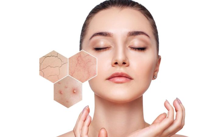 Sensitive Skin Care Write For Us
