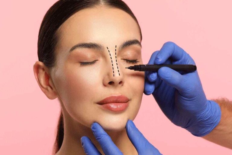 Rhinoplasty in London UK – 2026